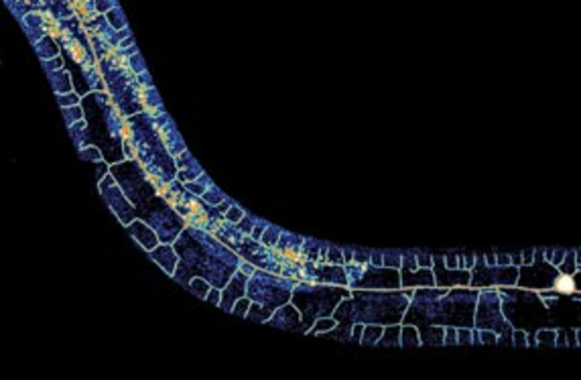 microscopic worm 311 (photo credit: Technion)