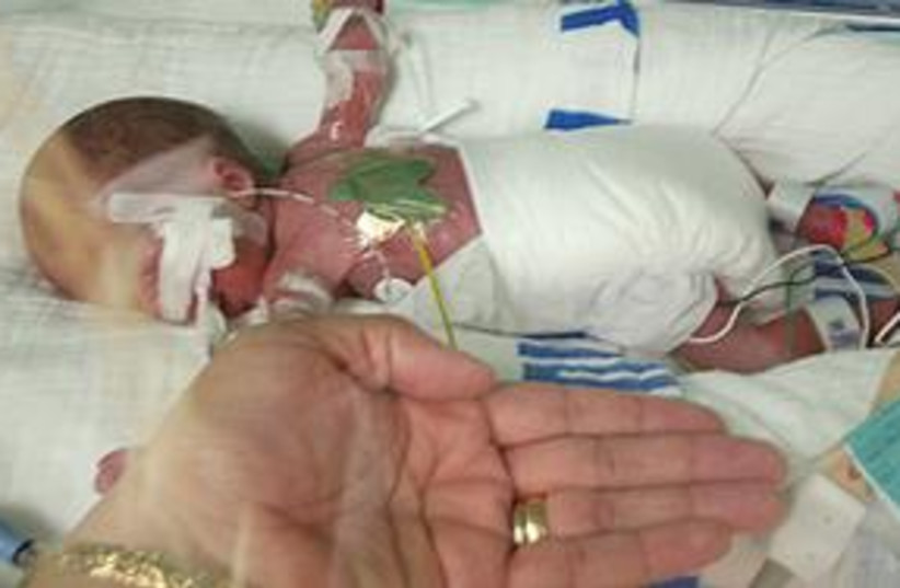 premature baby (photo credit: Kaplan Medical Center)