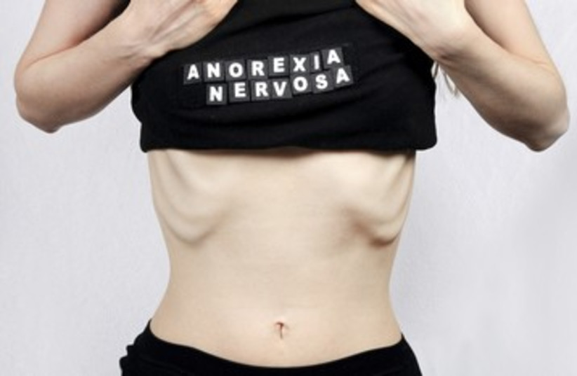 anorexia anorexic eating disorder skinny 390 (photo credit: iStockphoto)