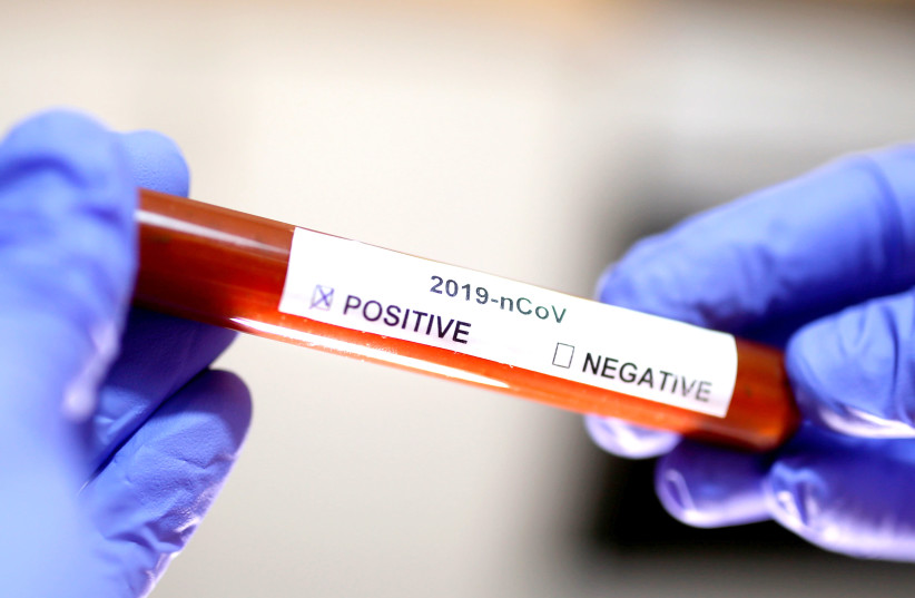  TEST TUBE with coronavirus label is seen at the end of January.  (photo credit: REUTERS)