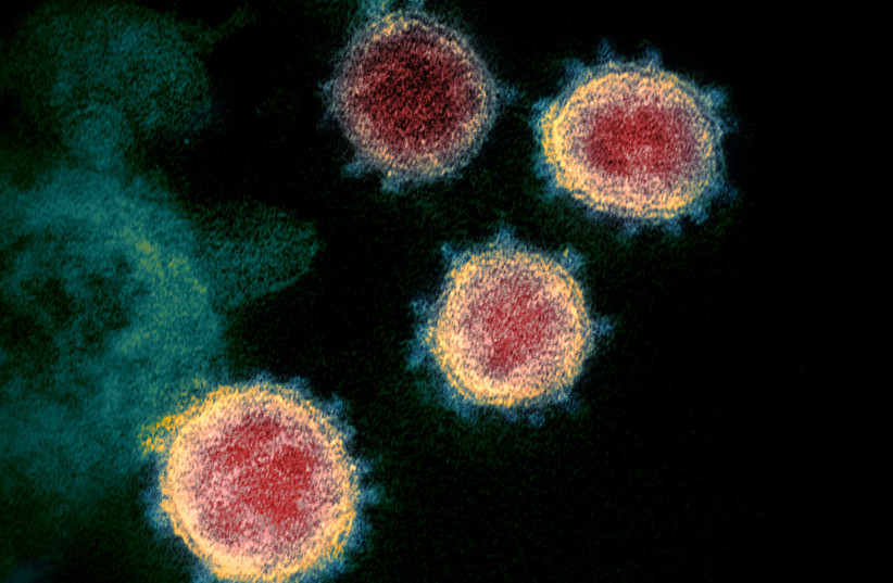  Novel Coronavirus SARS-CoV-2 (photo credit: Wikimedia Commons)