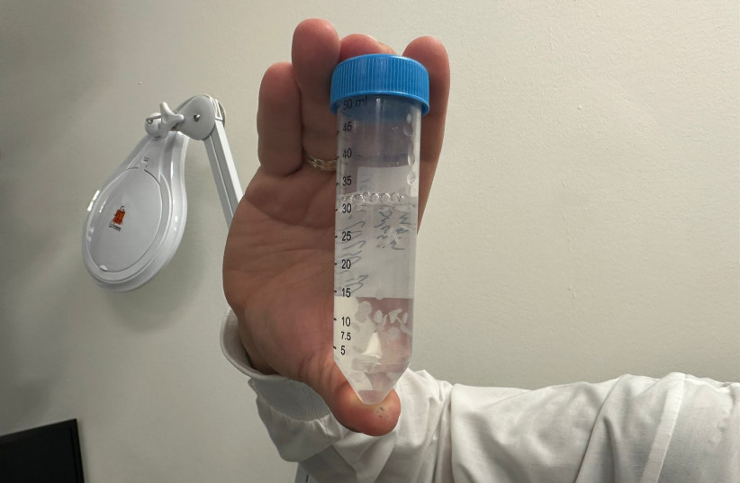 The cleaned scaffold is kept in a tube. Eventually, beta cells will be implanted into the scaffold and inserted subcutaneously, serving as a micro pancreas to manage insulin production (photo credit: HANNAH LEVIN/THE MEDIA LINE)