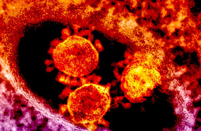  Colorized transmission electron micrograph showing particles of the Middle East Respiratory Syndrome Coronavirus (MERS-CoV). (photo credit: Wikimedia Commons)