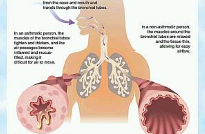 asthma 298.88 (photo credit: American Academy of Asthma, Allergy & Immunology)