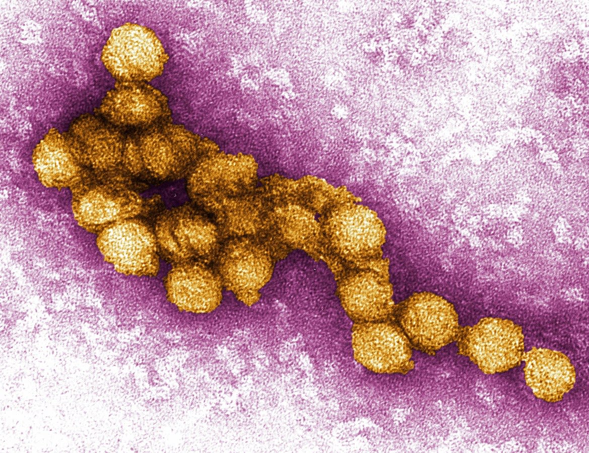 A micrograph of the West Nile Virus