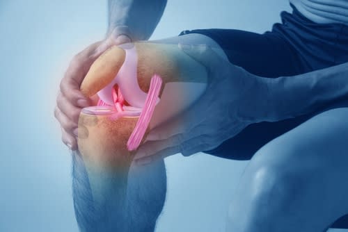 Among all injuries, an anterior cruciate ligament tear in the knee is considered one of the most severe