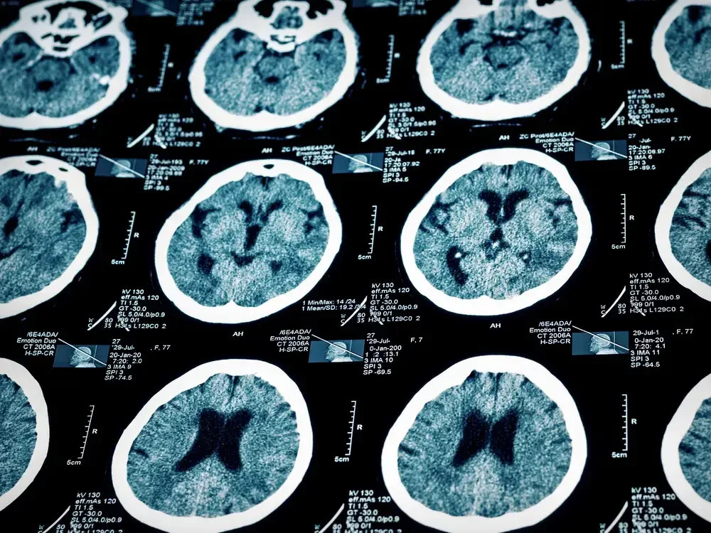 Even a relatively short daily exposure may provide the brain with a significant daylight signal.