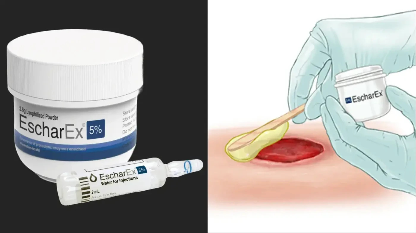 Preparing the wound for healing and closure. The Israeli treatment for chronic wounds.