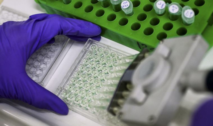 Israeli scientist claims breakthrough in HIV research