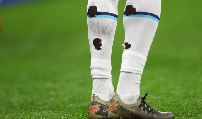 Qatar World Cup: Why do soccer players have holes in their socks? - The  Jerusalem Post
