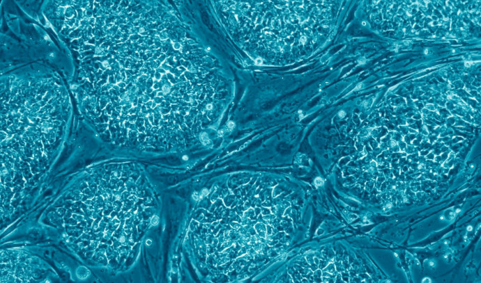 Cancer mutations in stem-cells used to replace diseased organs - Vimarsana News