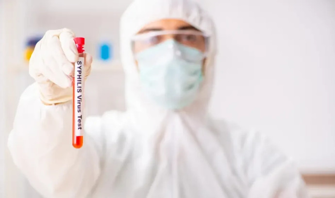 Israel sees alarming rise in syphilis infection rates - Health Ministry - Vimarsana News