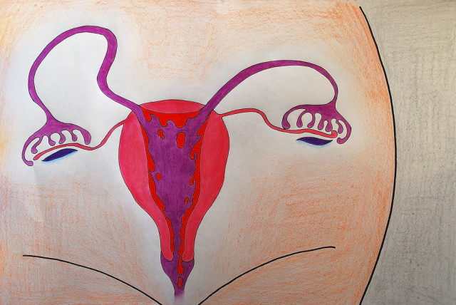 A colored drawing of female anatomy depicting a uterus, fallopian tubes and ovaries. Menstruation, monthly period (Illustrative) (credit: FLICKR)