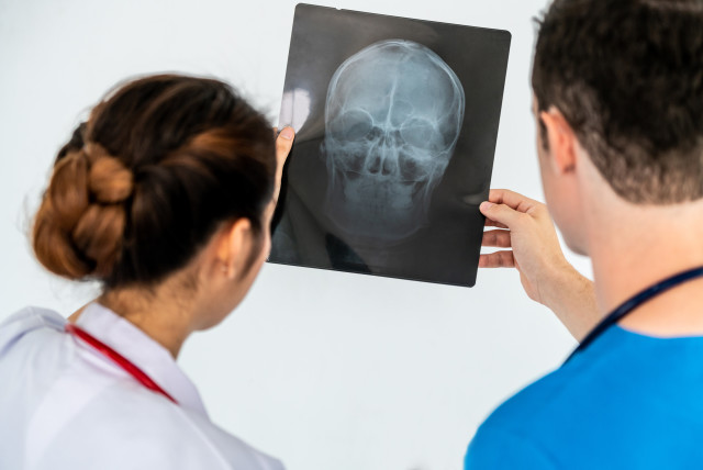 Female doctor looking at x ray film of patient head injury while working with another doctor at the hospital. Medical healthcare staff and doctor service. (photo credit: INGIMAGE)