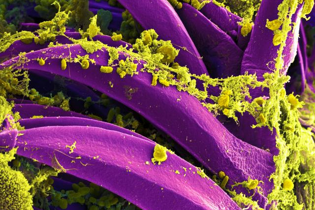  Scanning electron micrograph of Yersinia pestis, which causes bubonic plague, on proventricular spines of a Xenopsylla cheopis flea National Institute of Allergy and Infectious Diseases (NIAID) (credit: Wikimedia Commons)