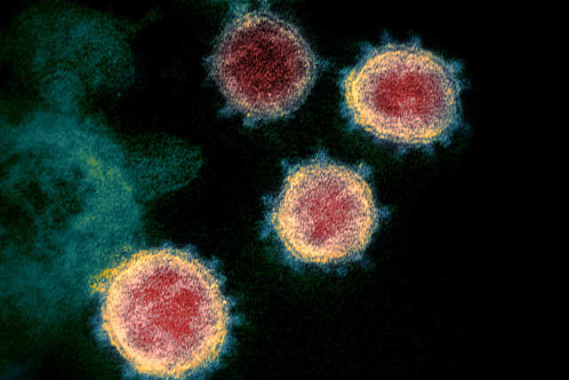  Novel Coronavirus SARS-CoV-2 (credit: Wikimedia Commons)