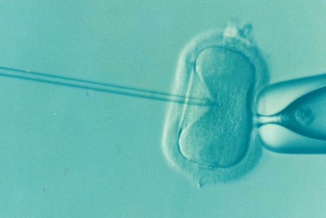  In vitro fertilization (Illustrative) (credit: PIXABAY)