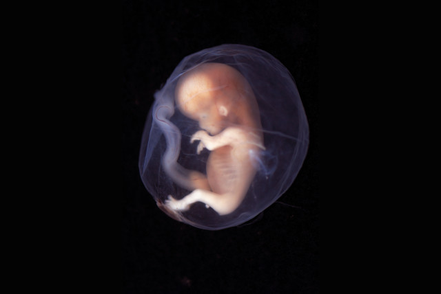  An embryo week 9-10 (photo credit: lunar caustic/Wikimedia Commons)