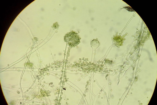  Conidiophores with conidia of the microscopic fungi Aspergillus oryzae under light microscope (credit: Wikimedia Commons)