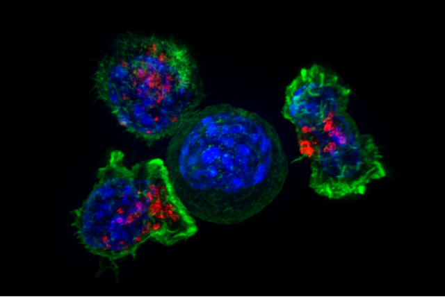  Superresolution image of a group of killer T cells (green and red) surrounding a cancer cell (blue, center). (credit: Wikimedia Commons)