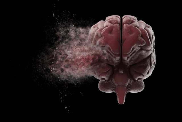 An artistic illustration of part of a brain fading away, indicating memory loss. (photo credit: INGIMAGE)
