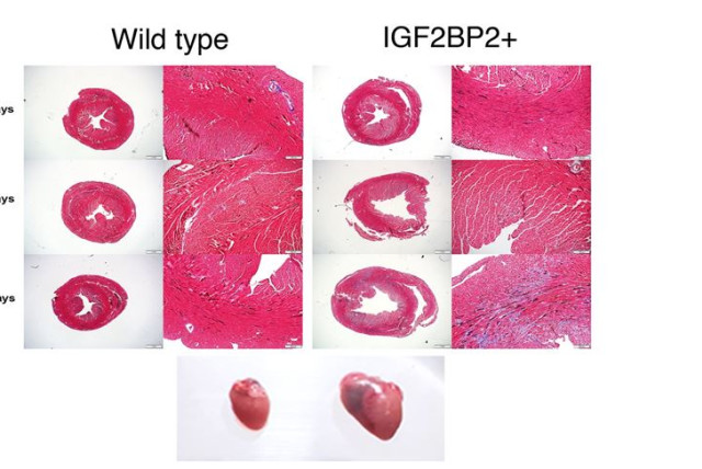 Hearts expressing transgenic IGF2BP2 become enlarged and develop DCM within 3-4 weeks. (credit: Dr. Miriam Krumbein)