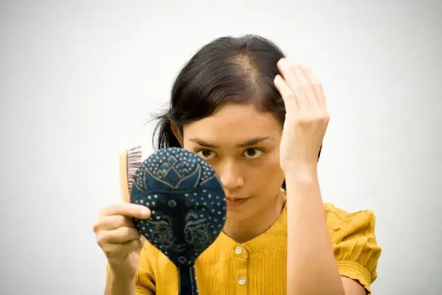   A treatment suitable for thinning hair but not baldness. A woman looks in the mirror  (credit: SHUTTERSTOCK)