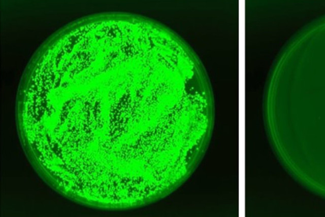 Tejido renal de ratones inmunodeprimidos con candidiasis invasiva. La cándida (verde fluorescente) florece normalmente sin cesar (izquierda), pero su crecimiento se retrasa en los ratones expuestos a la nueva levadura (derecha). (credit: WEIZMANN INSTITUTE OF SCIENCE)