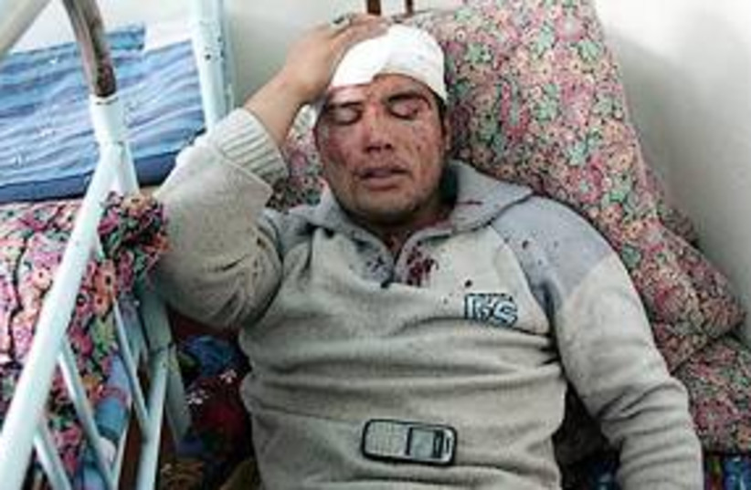 uzbek man injured 311 (photo credit: AP)
