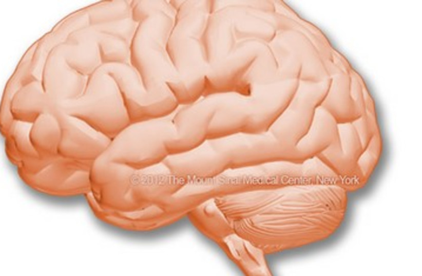 Brain 390 (photo credit: Nutritional Neuroscience)