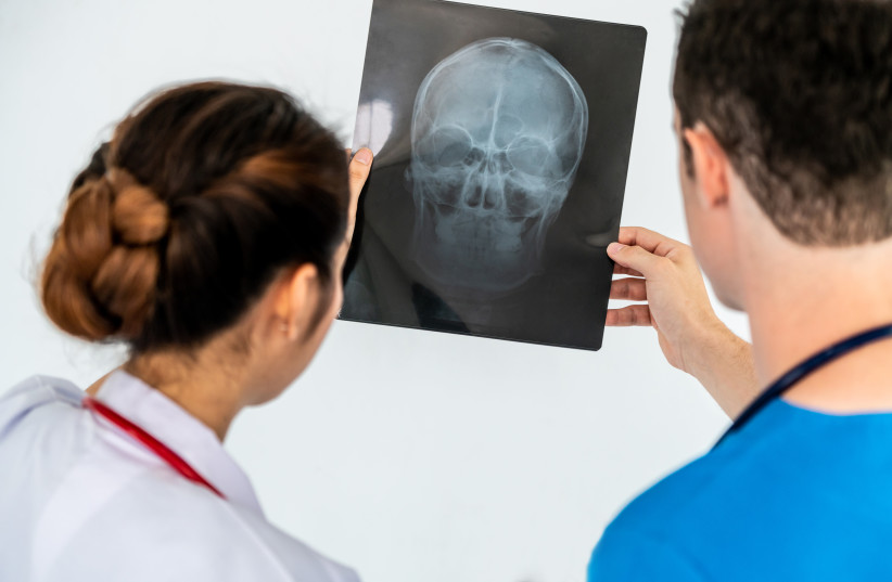  Female doctor looking at x ray film of patient head injury while working with another doctor at the hospital. Medical healthcare staff and doctor service. (photo credit: INGIMAGE)