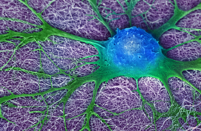  A growing mouse neural stem cell, April 21, 2017.  (credit: NIH Image Gallery/Flickr)