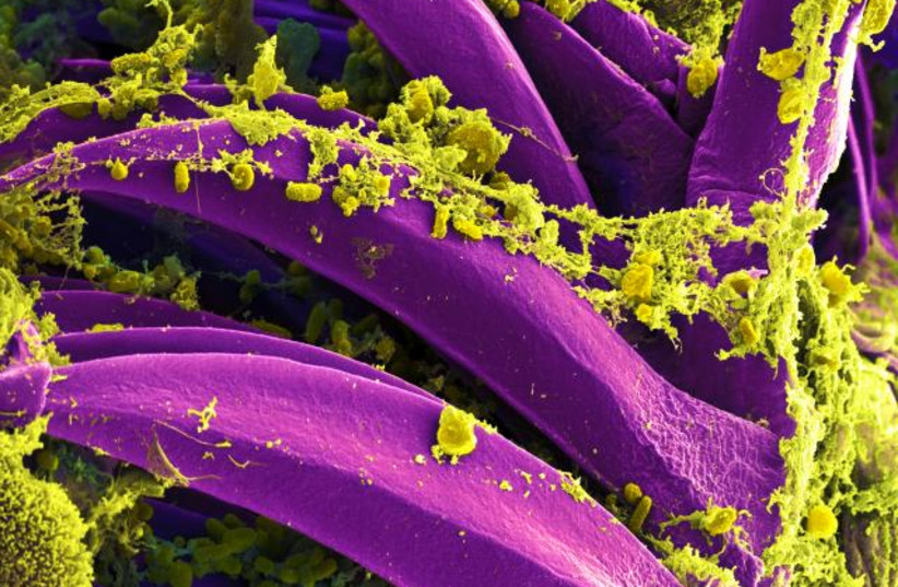  Scanning electron micrograph of Yersinia pestis, which causes bubonic plague, on proventricular spines of a Xenopsylla cheopis flea National Institute of Allergy and Infectious Diseases (NIAID) (credit: Wikimedia Commons)