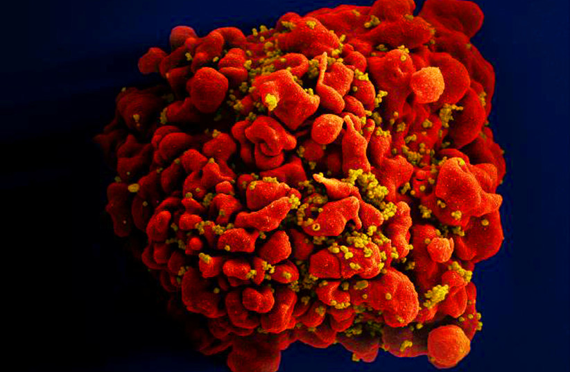 A digitally colorized scanning electron microscopic (SEM) image depicts a single, red colored H9-T cell that had been infected by numerous, spheroid shaped, mustard colored human immunodeficiency virus (HIV) particles attached to the cell's surface membrane. (credit: COURTESY NATIONAL INSTITUTE OF ALLERGY AND INFECTIOUS DISEASES (NIAID)/HANDOUT VIA REUTERS)