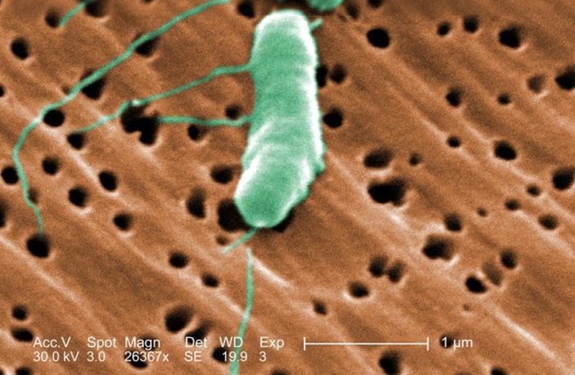  Vibrio vulnificus bacteria (photo credit: CREATIVE COMMONS)