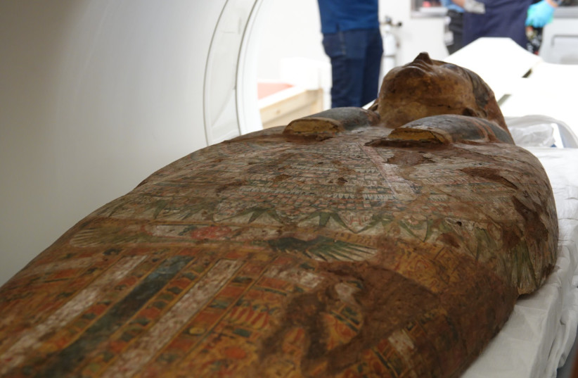 An Ancient Egyptian coffin lid undergoes a CT scan at Shaare Zedek Medical Center, May 21, 2023. (photo credit: SHAARE ZEDEK MEDICAL CENTER)