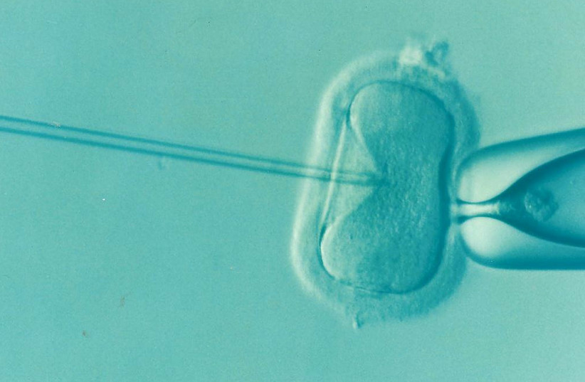  In vitro fertilization (Illustrative) (credit: PIXABAY)
