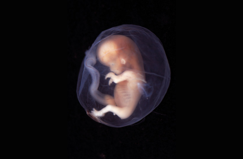  An embryo week 9-10 (photo credit: lunar caustic/Wikimedia Commons)