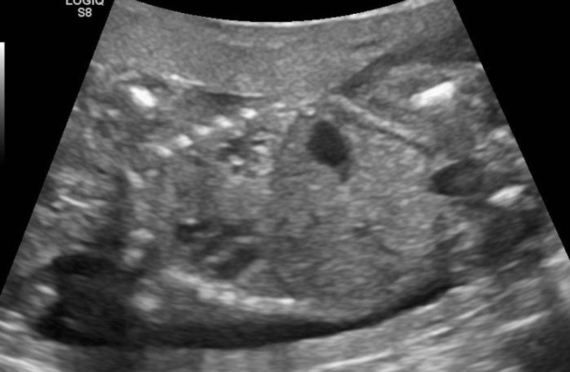  Illustrative image of a fetus. (credit: Wikimedia Commons)