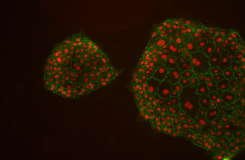  Induced placental stem cells: Green membrane, red protein (credit: MORIYAH NAAMA, BUGANIM LAB)