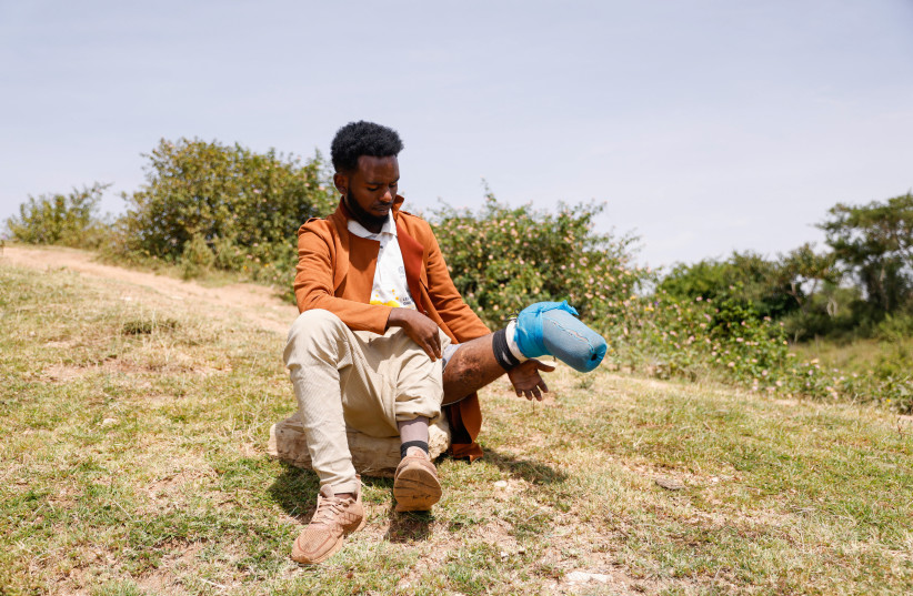 Mustafa Sofian, 22, an Ethiopian migrant who said he lost his left leg after the Saudi border guards fired at him, wears his prosthetic leg after being repatriated by the International Organization for Migration (IOM) in Harar, Ethiopia, August 20, 2023. (credit: TIKSA NEGERI / REUTERS)