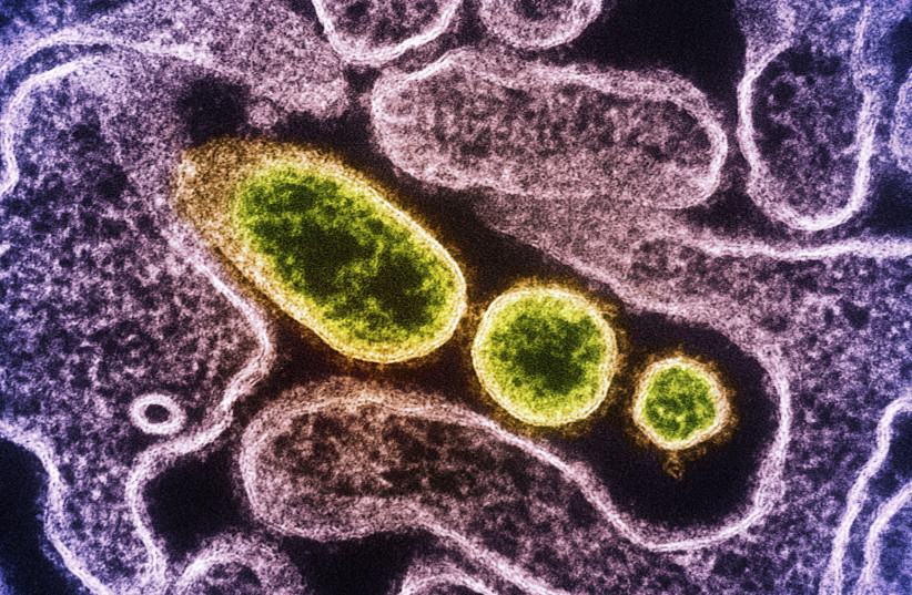  Colorized transmission electron micrograph of mature extracellular Nipah virus particles (yellow) near the periphery of an infected VERO cell (purple). Image captured at the NIAID Integrated Research Facility in Fort Detrick, Maryland. (credit: NIAID/FLICKR)