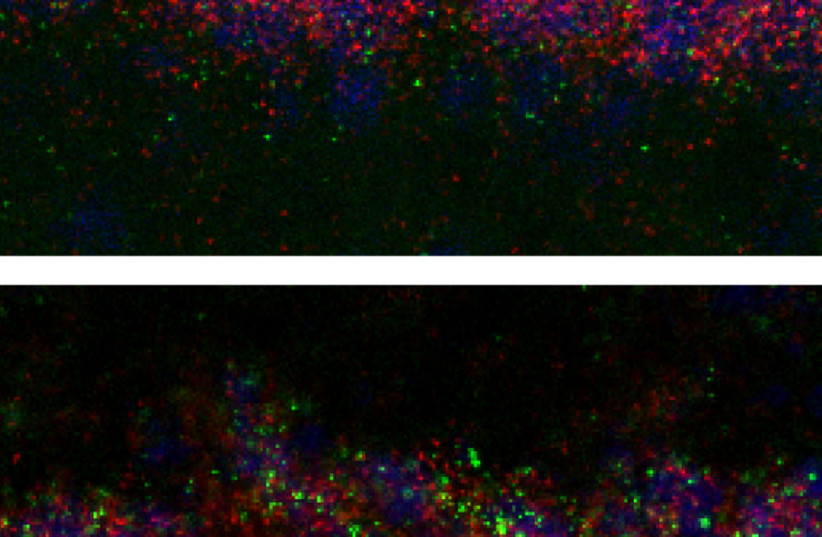  Bullying produced different effects on neurons in the hippocampus of adult mice – depending on whether these mice had been exposed to stress in infancy (bottom) or not (top). The images reveal some of the most striking differences in gene expression (green) in the excitatory (red) neurons (credit: Prof. Alon Chen)