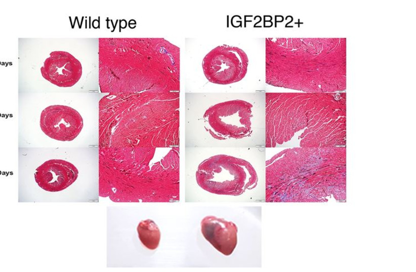 Hearts expressing transgenic IGF2BP2 become enlarged and develop DCM within 3-4 weeks. (credit: Dr. Miriam Krumbein)