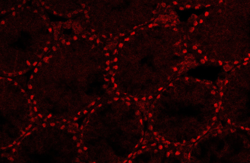  Image of real testes of 28-day-old mice. The Sertoli cells, which are the cells responsible for the formation of the tubules in the testicle, are marked in red and the unmarked tubules of the testicle in which the sperm cells are produced are clearly seen  (credit: Aviya Stopel)