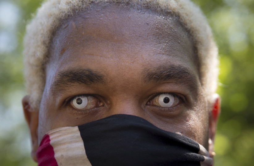  A participant wearing contact lenses poses during the West Indian Day Parade in Brooklyn, New York September 7, 2015. The parade, which takes place annually, celebrates Caribbean culture and history.  (credit: Andrew Kelly/Reuters)