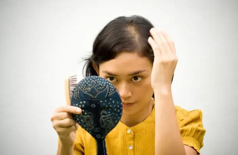   A treatment suitable for thinning hair but not baldness. A woman looks in the mirror  (credit: SHUTTERSTOCK)