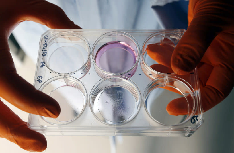 El investigador Fabien Guillemot comprueba células humanas después de una impresión bio-3D con láser en el laboratorio Biotis del INSERM (Instituto Nacional de Salud e Investigación Médica) en Pessac, cerca de Burdeos, el 29 de octubre de 2014. (crédito: REGIS DUVIGNAU /REUTERS)