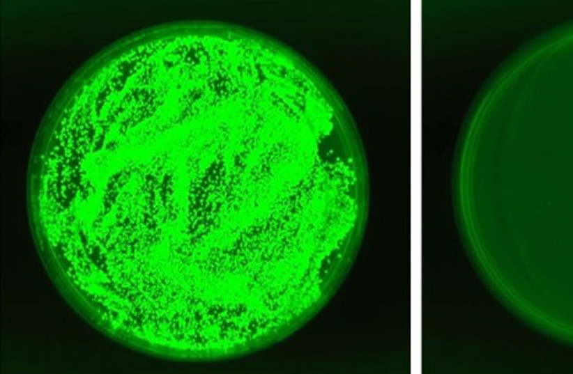  Kidney tissue from immunosuppressed mice with invasive candidiasis. The candida (fluorescent green) normally flourishes unabated (left), but its growth is delayed in mice exposed to the new yeast (right). (credit: WEIZMANN INSTITUTE OF SCIENCE)