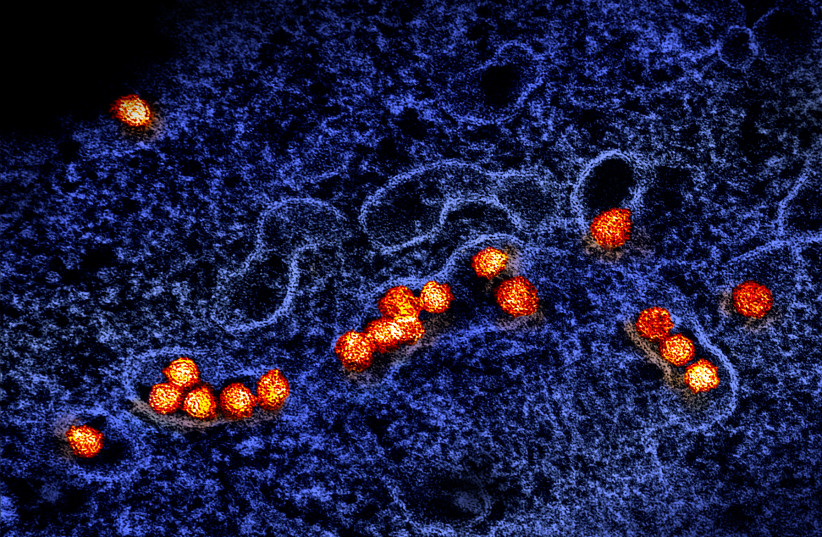  Transmission electron micrograph of West Nile virus particles (orange/gold) replicating within the cytoplasm of an infected VERO E6 cell (blue). Image captured at the NIAID Integrated Research Facility (IRF) in Fort Detrick, Maryland. (credit: NIAID/FLICKR)
